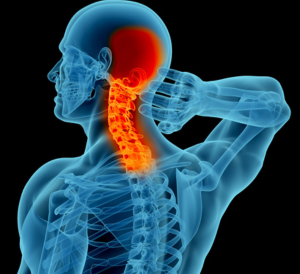 Neck Pain